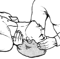 1. Положите потерпевшего на спину и встаньте перед ним на колени. Оттяните голову назад и вычистите ему рот.