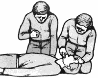 1. Положите больного на спину на твердую поверхность. Один человек оттягивает голову больного назад, а другой - резко давит ему на грудь.